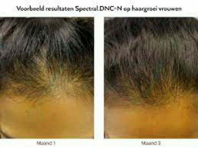 Onderzoek En Studies Over Koperpeptiden Voor Haargroei